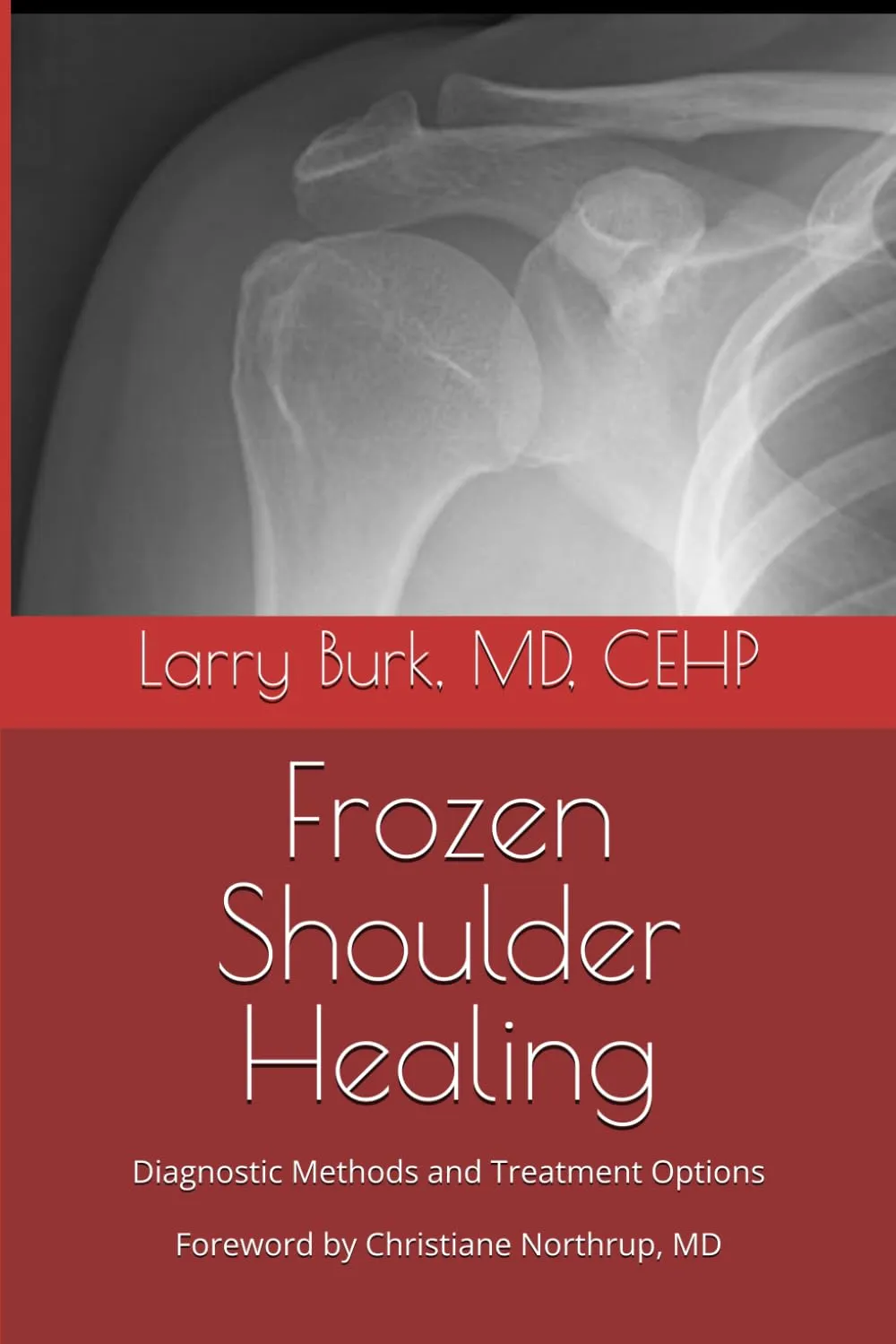 Frozen Shoulder Healing: Diagnostic Methods and Treatment Options Paperback  April 30, 2025